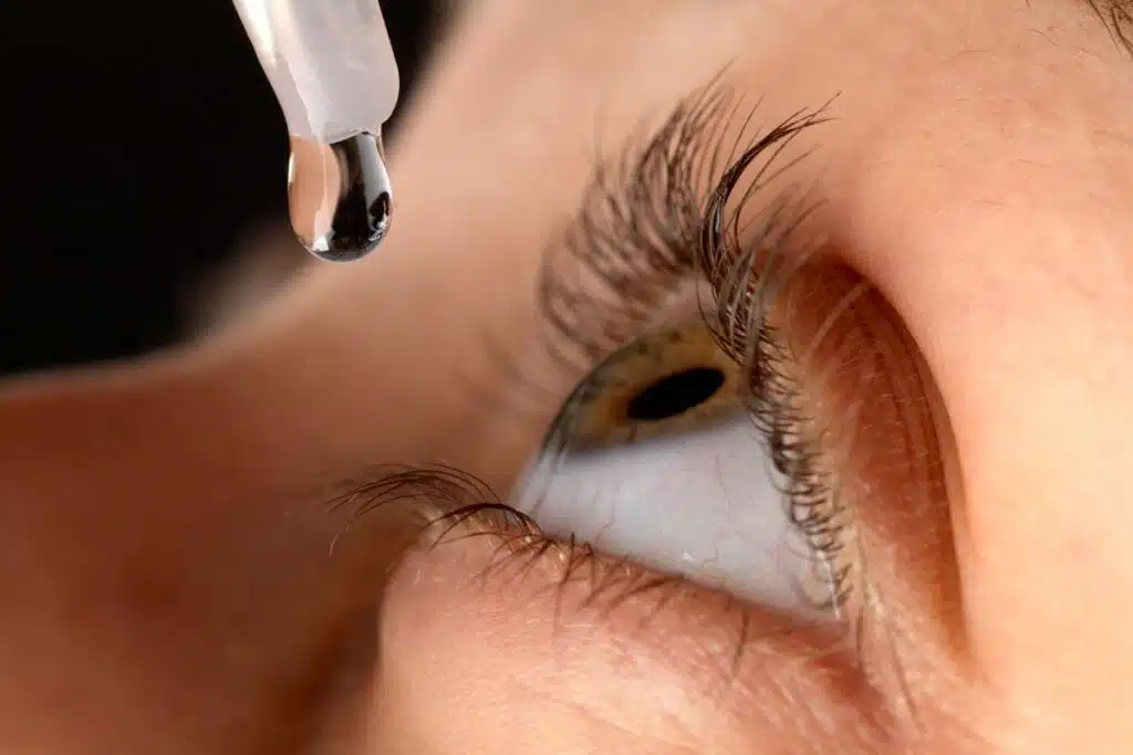 Close up of a woman putting eye drops into her eye, representing the Walmart Ezricare artificial tears  bacteria class action.