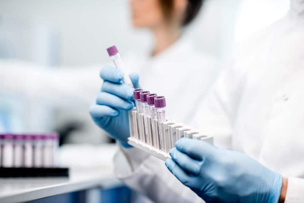 Close up of a lab technician putting test tubes into a holder, representing the FDA lab tests regulation.
