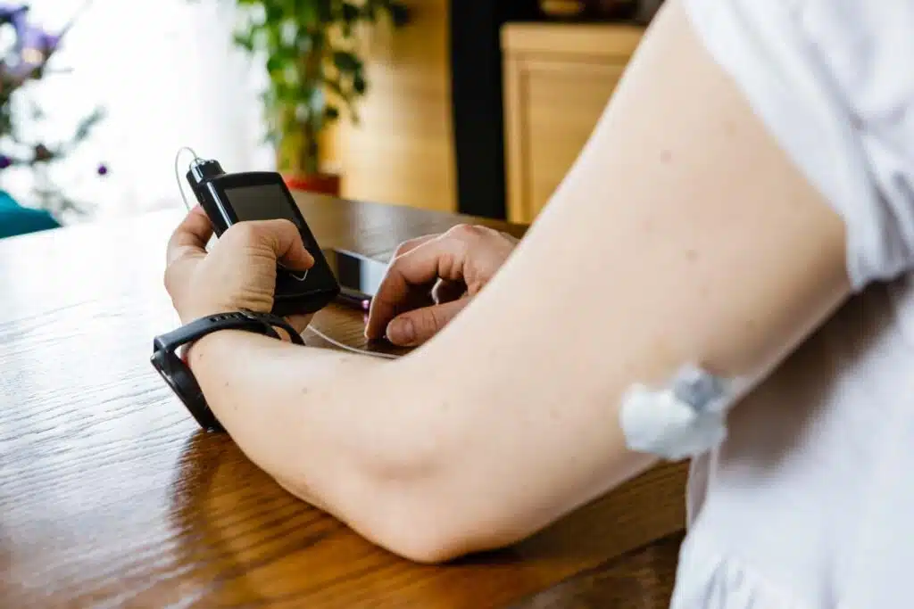 Close up of a woman using an insulin pump, representing the insulin pump app recall.
