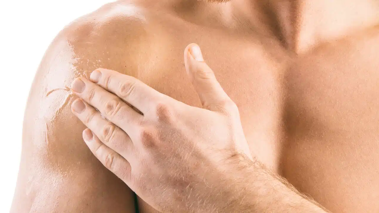 Testosterone Replacement Therapy (TRT)