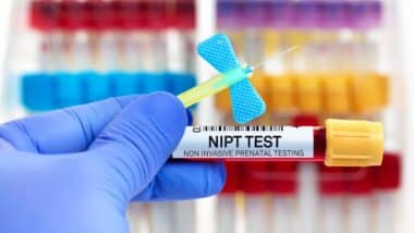 Blood sample of patient for Non invasive Prenatal Testing test NIPT in laboratory.
