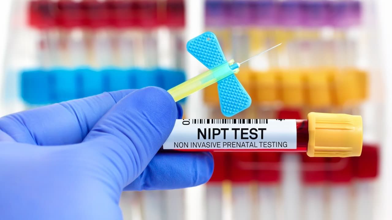 Blood sample of patient for Non invasive Prenatal Testing test NIPT in laboratory.
