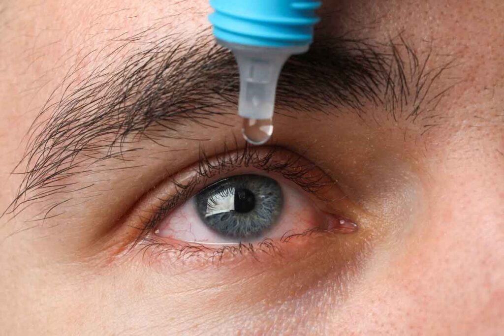 Close up of a man putting eyedrops in his eyes, representing the eye drop settlement.