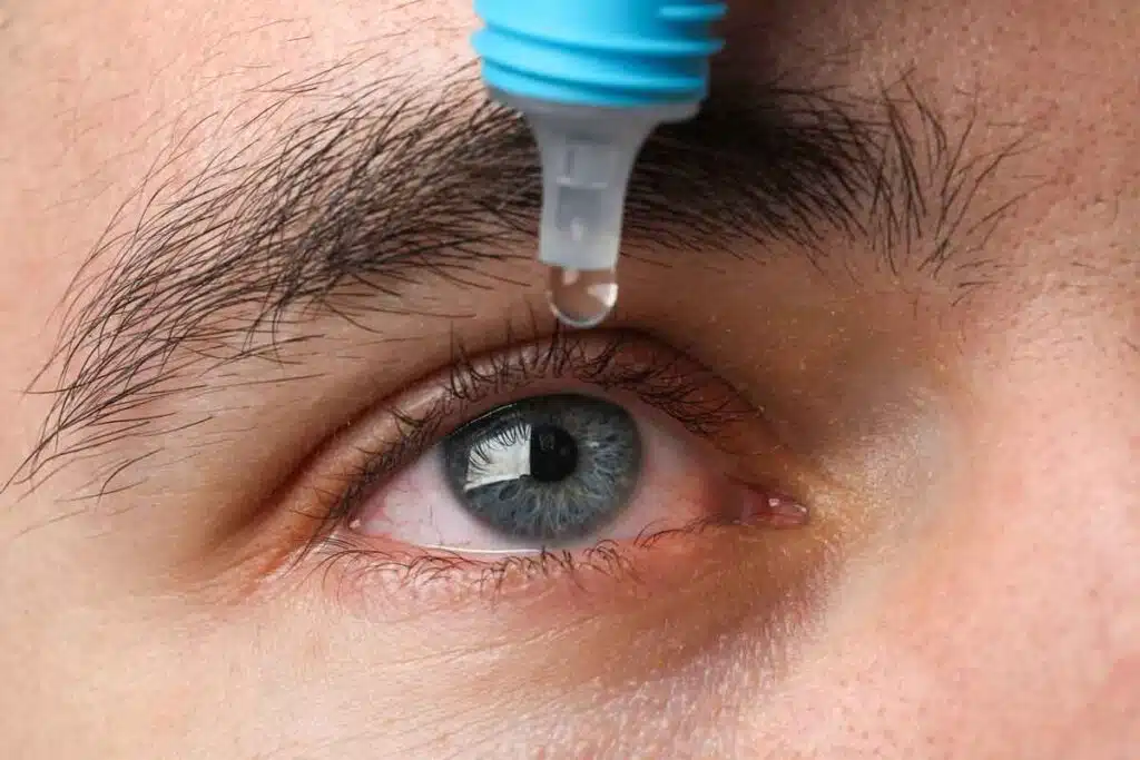Close up of a man putting eyedrops in his eyes, representing the eye drop settlement.