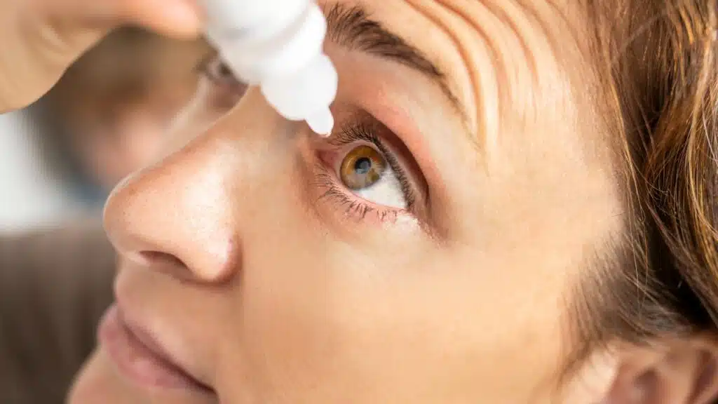 woman applying eye drops to her eyes