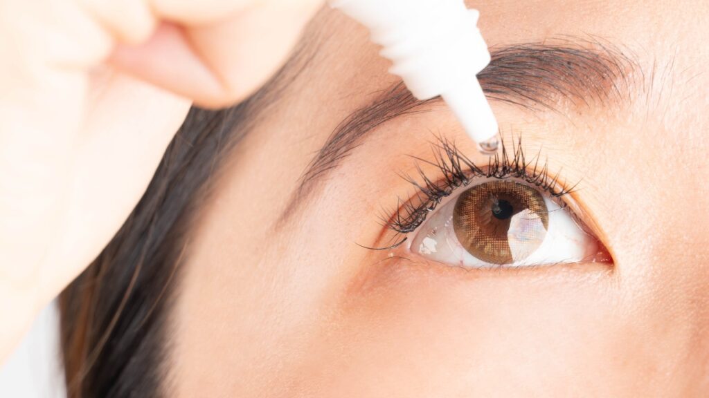Woman applying artificial tear eye drop for relief dry eyes, irritated eye, conjunctivitis or optical symptoms.