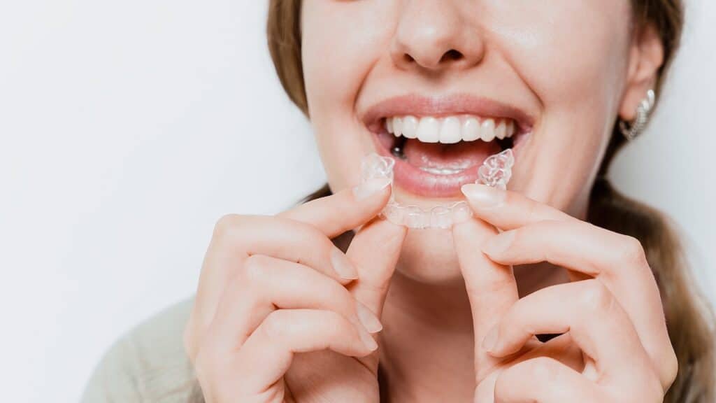 Smiling woman with a snow-white smile demonstrate clear teeth aligner for orthodontal straightening teeth treatment