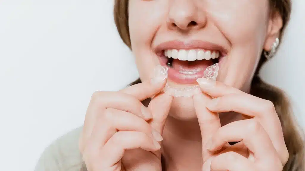 Smiling woman with a snow-white smile demonstrate clear teeth aligner for orthodontal straightening teeth treatment