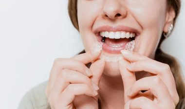 Smiling woman with a snow-white smile demonstrate clear teeth aligner for orthodontal straightening teeth treatment
