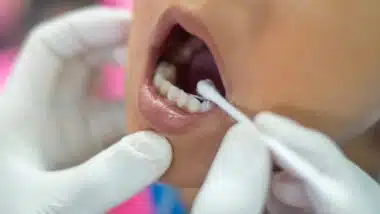 Children receive fluoride medicine by a dentist at dental clinic.