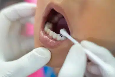 Children receive fluoride medicine by a dentist at dental clinic.
