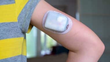 Child wearing Omnipod diabetes continuous glucose monitor on arm for diabetic insulin management