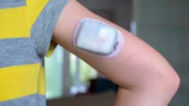 Child wearing Omnipod diabetes continuous glucose monitor on arm for diabetic insulin management
