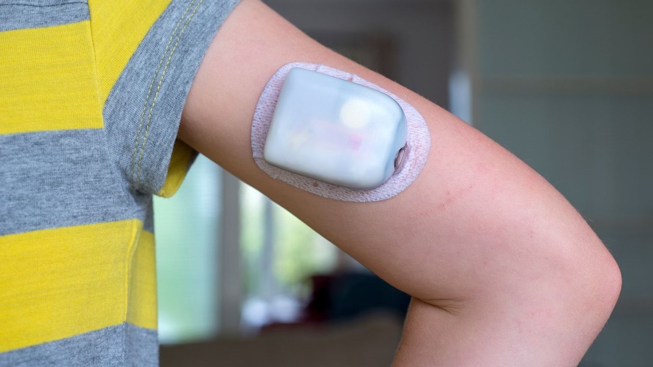 Child wearing Omnipod diabetes continuous glucose monitor on arm for diabetic insulin management