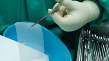 Non Absorbable Mesh for Hernia Repair.