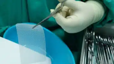 Non Absorbable Mesh for Hernia Repair.