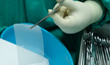 Non Absorbable Mesh for Hernia Repair.