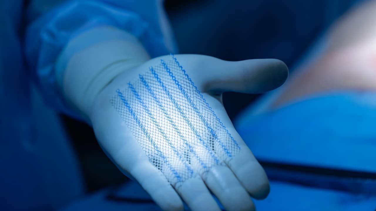 Surgeon's gloved hand displaying medical mesh after umbilical hernia removal under blue light.